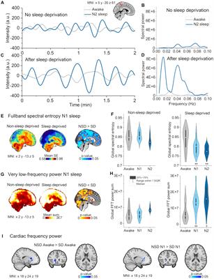 Effect of sleep deprivation and NREM sleep stage on physiological brain pulsations